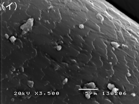 何かの毛の走査電子顕微鏡像（イ）